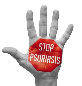La prévention du psoriasis